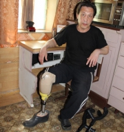 Без ноги и права на инвалидность