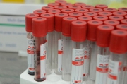 Четыре новых случая заражения коронавирусом зарегистрированы в Липецкой области